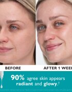Peter Thomas Roth Collagen Skinjection™ Plumping & Firming Serum intenzíven feszesítő szérum kollagénnel 30 ml