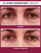Peter Thomas Roth EVEN SMOOTHER™ Glycolic Retinol Hydra-Gel Eye Patches hidratáló gél párnácskák a szem köré 60 db