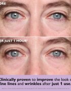 Peter Thomas Roth Instant FIRMx Collagen Infusion Tighteneing Eye Patches feszesítő géles párnácskák a szemek alá 1 db