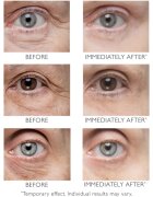 Peter Thomas Roth Instant FIRMx Eye szemkrém a bőr fiatalításáért 15 ml