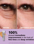 Peter Thomas Roth Instant FIRMx Eye szemkrém a bőr fiatalításáért 20 ml