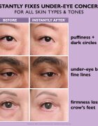 Peter Thomas Roth Instant FIRMx Eye szemkrém a bőr fiatalításáért 20 ml