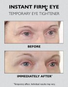Peter Thomas Roth Instant FIRMx Eye szemkrém a bőr fiatalításáért 30 ml