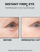 Peter Thomas Roth Instant FIRMx Eye szemkrém a bőr fiatalításáért 30 ml