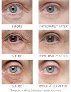 Peter Thomas Roth Instant FIRMx Eye szemkrém a bőr fiatalításáért 30 ml