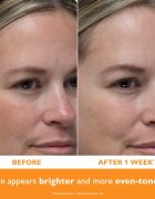 Peter Thomas Roth Potent-C™ Power Serum bőrélénkítő szérum C-vitaminnal a bőröregedés ellen 30 ml