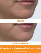 Peter Thomas Roth Potent-C™ Power Serum bőrélénkítő szérum C-vitaminnal a bőröregedés ellen 30 ml