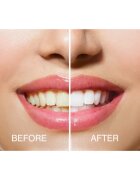 RIO USB teeth whitening fogfehérítő szett