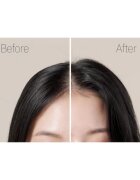RYO Root:Gen Hair Loss Care Treatment erősítő ápolás hajhullás ellen hölgyeknek 353 ml