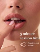 Silk'n LED LipMask LED kezelőmaszk az ajkakra 1 db
