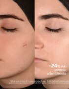 SKINSOO PurifyCell Exosome Cleanser hámlasztó tisztító gél 250 ml