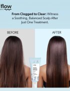 so!flow Cleansing Trichological Peeling peeling fejbőrre 100 ml
