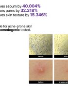 Some By Mi Retinol Intense Reactivating Serum ránctalanító retinol szérum az érzékeny arcbőrre 30 ml