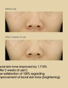 Some By Mi Yuja Niacin 30 Days Miracle Brightening Toner élénkítő tonik 150 ml