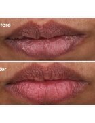 The Ordinary PHA 5% Exfoliating Lip Serum feszesítő hámlasztó szérum az ajkakra 15 ml