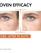 Vichy Liftactiv Supreme fényesítő hatású arcszérum C vitamin 20 ml