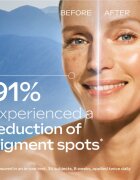 Weleda Blue Gentian & Edelweiss bőrfeszesítő szérum az arcra a pigment foltok ellen 30 ml