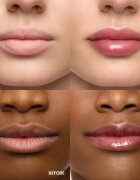 WONDERSKIN Lip Rehab Serum Oil ajak olaj árnyalat Honey 3.57 ml