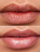WONDERSKIN Lip Rehab Therapy Oil ajak olaj hidratáló hatással árnyalat Clear 357 ml
