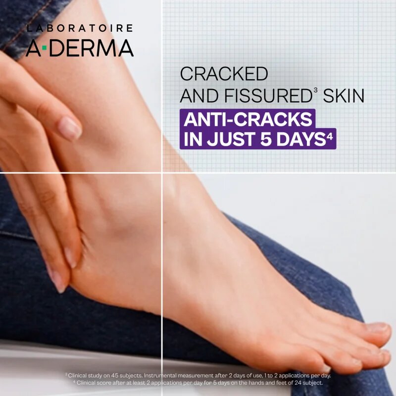 A-Derma Epitheliale A.H. Ultra Balm Repairing Balm-Patch regeneráló balzsam száraz és nagyon száraz bőrre 50 g
