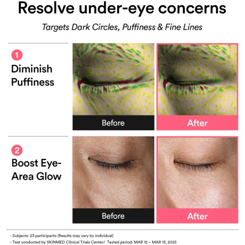 Abib PDRN Retinal Eye Patch Glow Jelly szem alatti párnácskák a ráncok duzzanatok és sötét karikák ellen 60 db