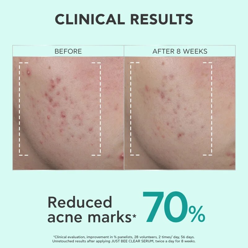 Apivita Just Bee Clear Serum szérum zsíros és problémás arcbőrre 30 ml