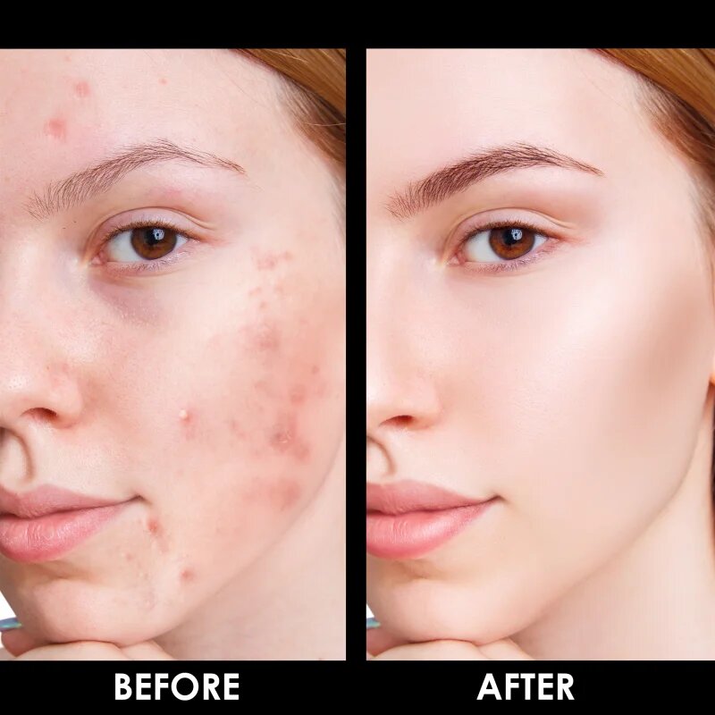 Arval Puractiva Bio-Balancing Cream tisztító krém regeneráló hatással 50 ml