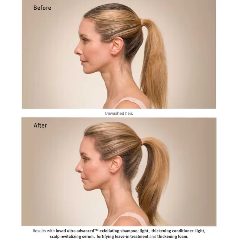 Aveda Invati Ultra Advanced™ Revitalizing Scalp Serum regeneráló szérum a hajra és a fejbőrre 30 ml