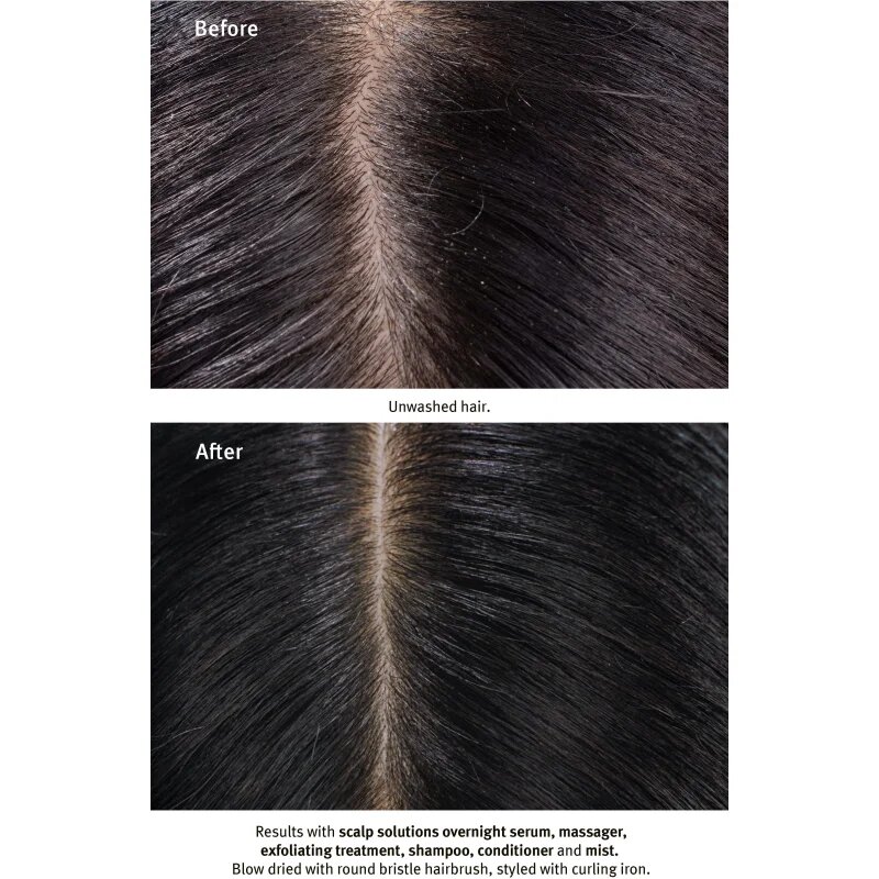 Aveda Scalp Solutions Overnight Scalp Renewal Serum éjszakai szérum egészséges fejbőrre 50 ml