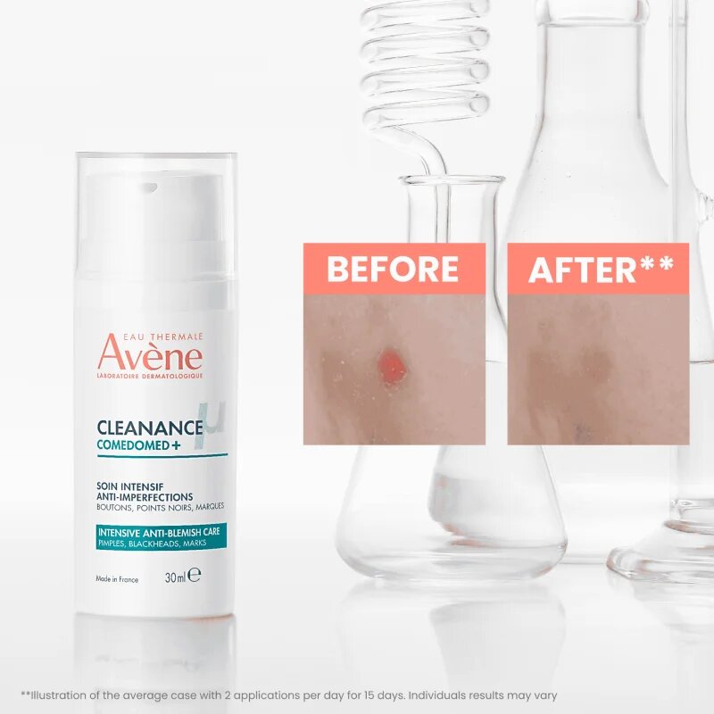Avène Cleanance Comedomed+ intenzív ápolás a pattanásos bőr hibáira 30 ml