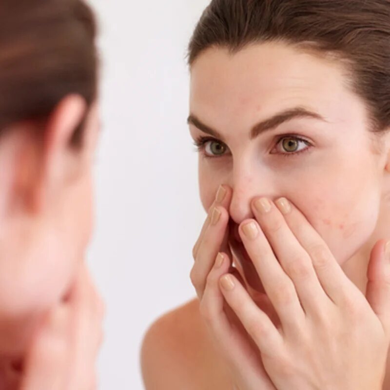 Avène Cleanance micellás víz kombinált és zsíros bőrre 400 ml