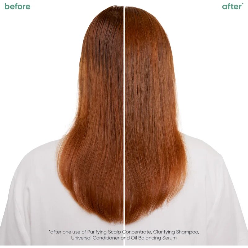 Biolage ScalpSync hajszérum zsíros hajra 50 ml