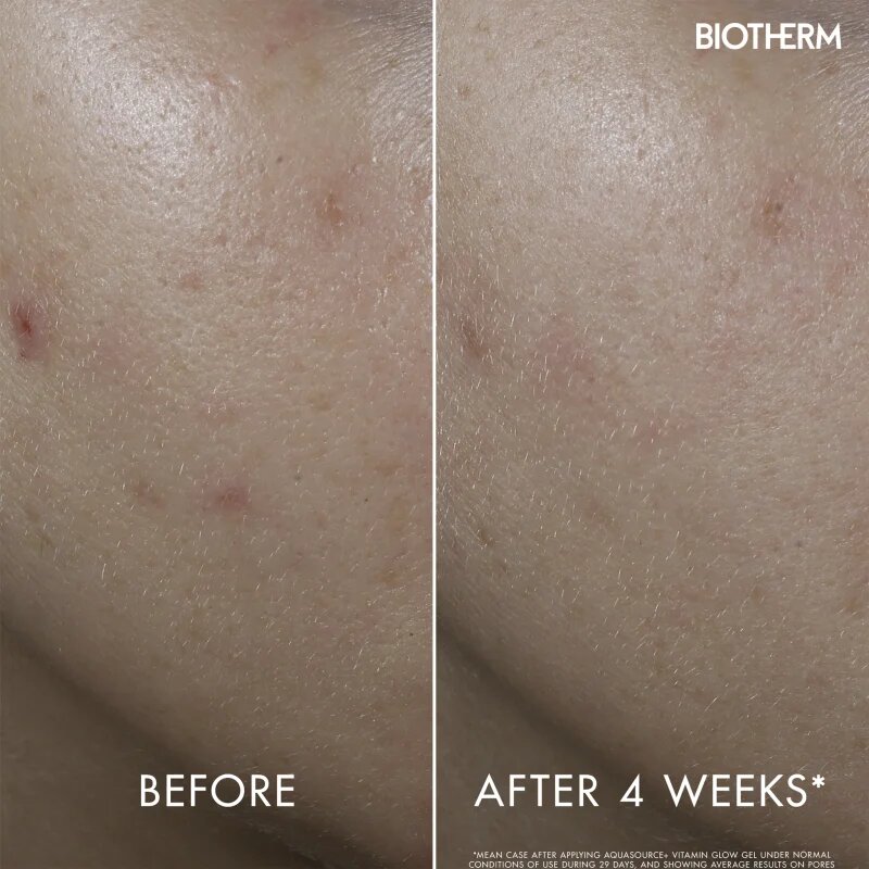 Biotherm Aquasource+ Vitamin Glow Gel arcgél 30 ml