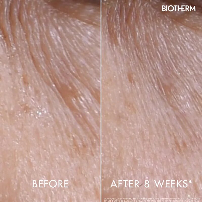 Biotherm Blue Peptides Eyes Lips Contour Reshaper bőrápoló a szem környékére és az ajkakra 15 ml