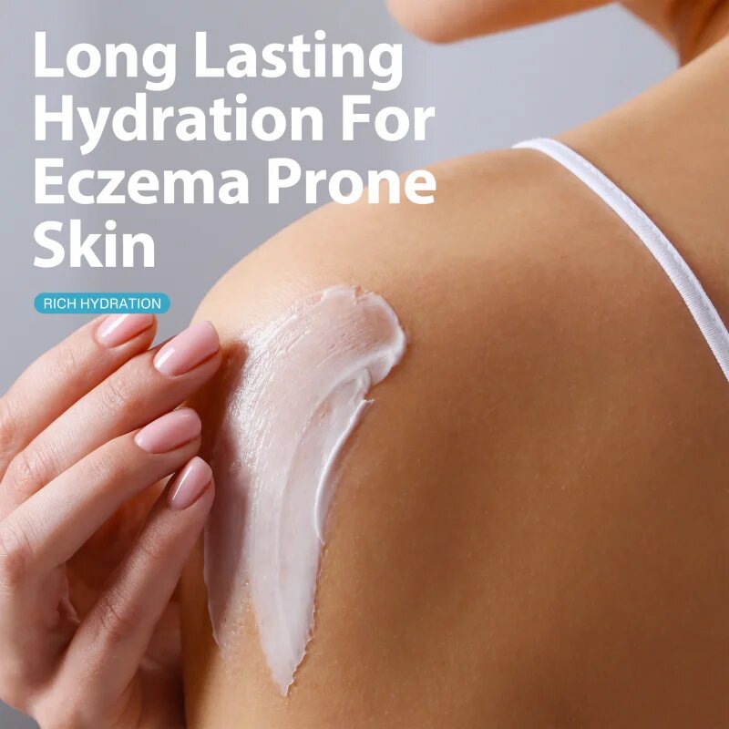 Cetaphil Pro ItchControl Repair regeneráló krém a száraz és ekcémás bőrt 227 ml