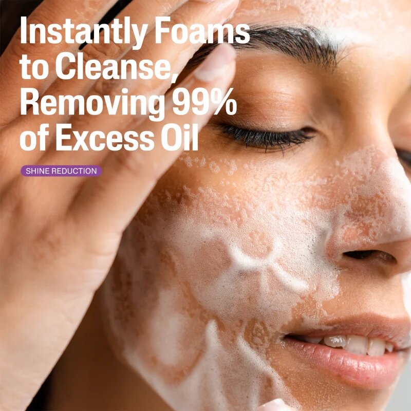 Cetaphil PRO SpotControl Oil Remowing Foam Wash tisztító hab zsíros és problémás bőrre 235 ml