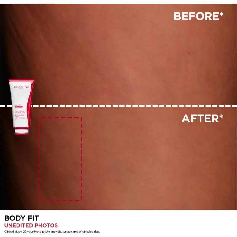 Clarins Body Fit Skin Smoothing Expert feszesítő krém narancsbőrre 200 ml