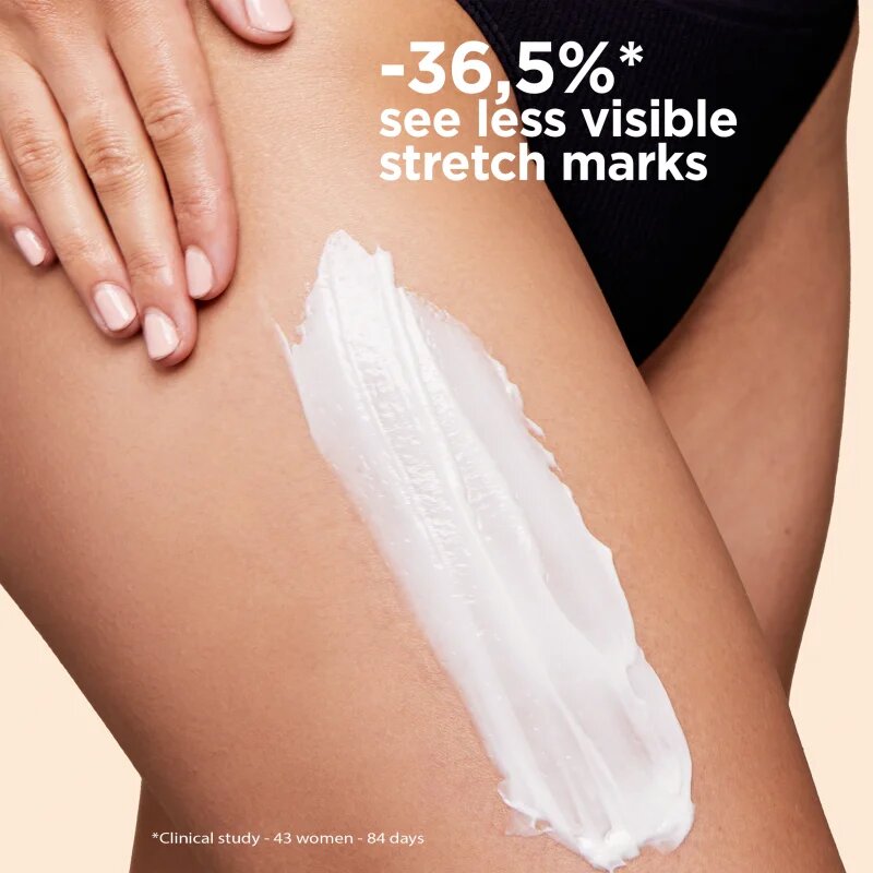 Clarins Body Partner Stretch Mark Expert nyugtató testápoló krém a striák megelőzésére és csökkentésére 175 ml