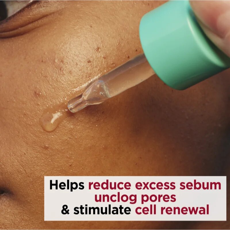 Clarins My Pure-Reset Resurfacing Blemish Serum regeneráló szérum az aknéra hajlamos zsíros bőrre 30 ml