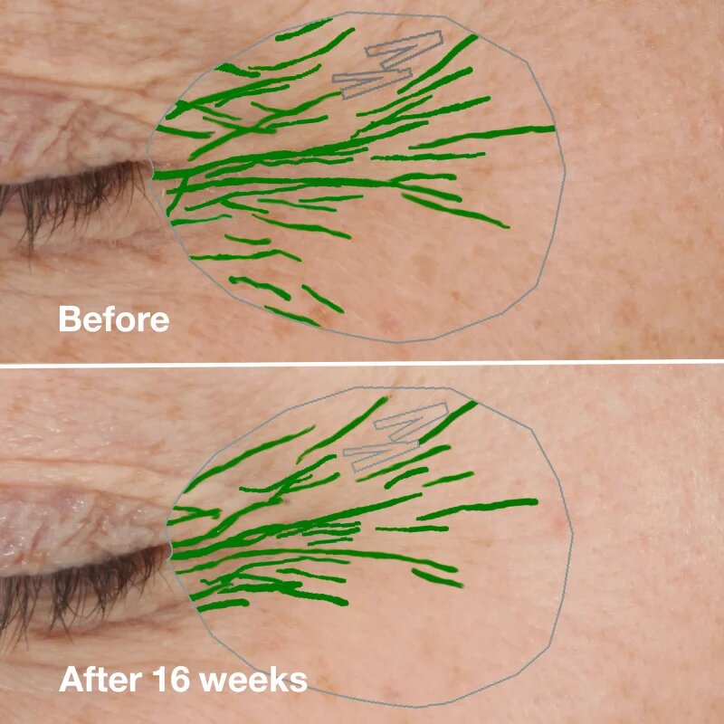 Clinique Smart Clinical™ Repair Wrinke Correcting Serum bőr szérum ránckorrekcióhoz 100 ml