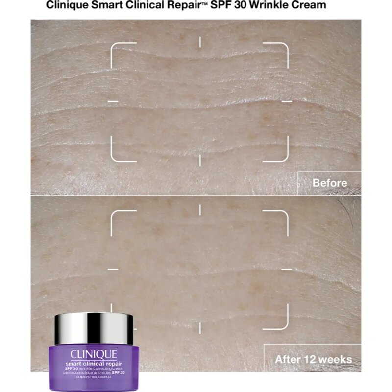 Clinique Smart Clinical™ Repair Wrinkle Correcting Cream SPF 30 ránctalanító krém SPF 30 50 ml