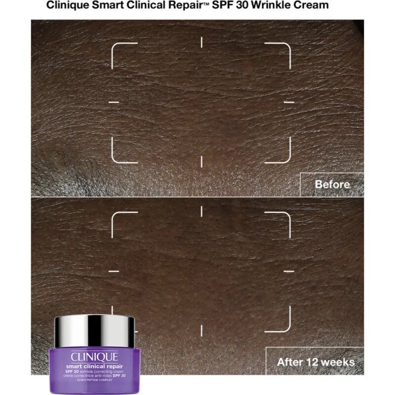 Clinique Smart Clinical™ Repair Wrinkle Correcting Cream SPF 30 ránctalanító krém SPF 30 50 ml
