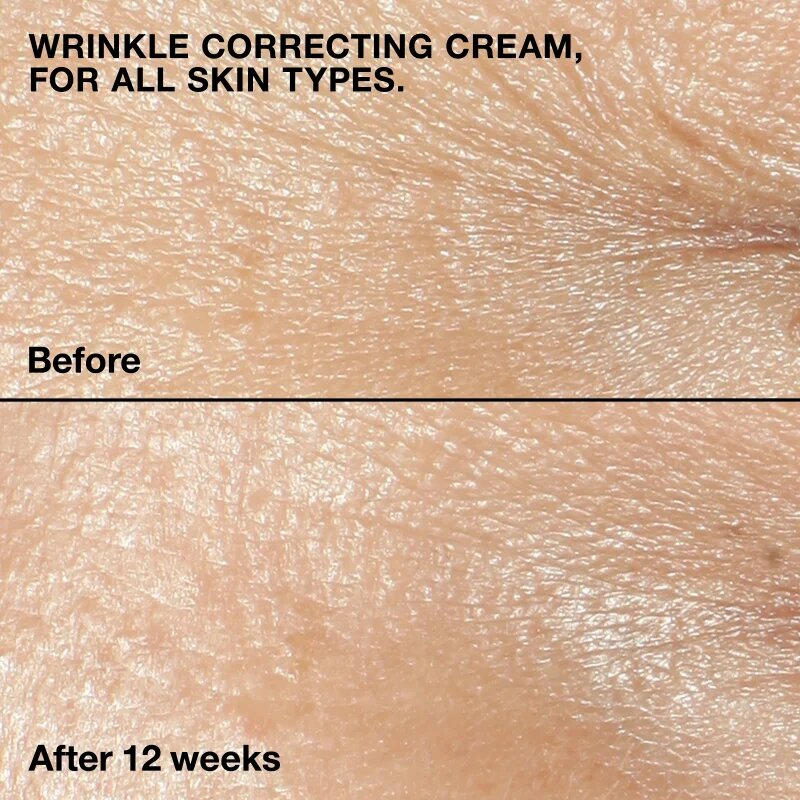 Clinique Smart Clinical™ Repair Wrinkle Correcting Cream Tápláló ránctalanító krém 50 ml