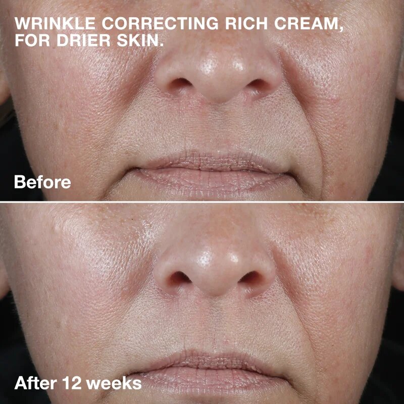 Clinique Smart Clinical™ Repair Wrinkle Correcting Cream Tápláló ránctalanító krém 75 ml