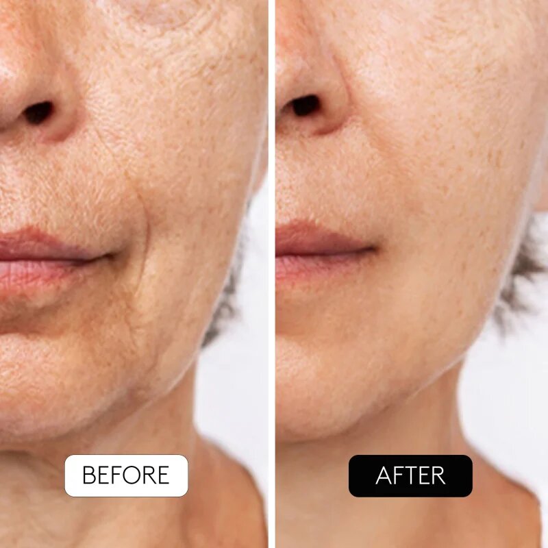Cocunat Clinical AHA Complex 10% Gyengéd éjszakai peeling szérum öregedés ellen 30 ml