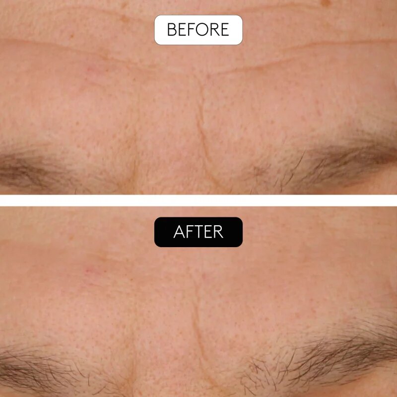 Cocunat Clinical Beauty Filler szett a bőröregedés ellen
