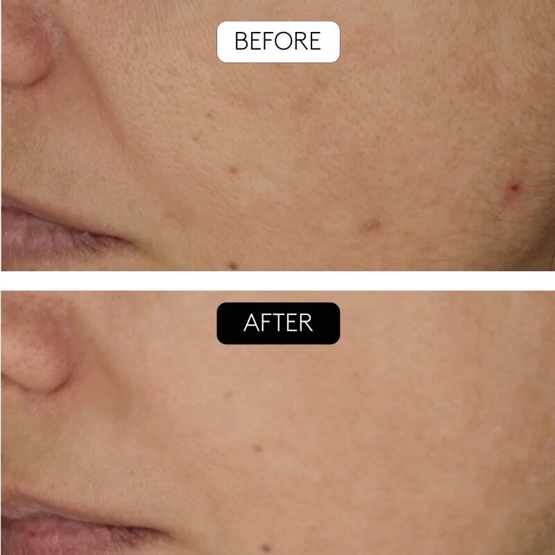 Cocunat Clinical Beauty Filler szett a bőröregedés ellen