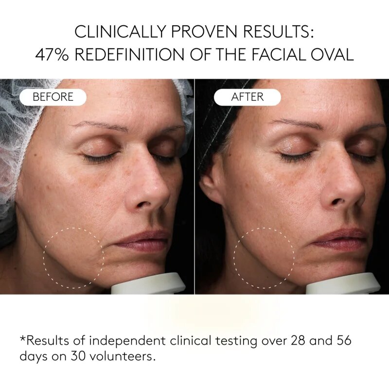 Cocunat Clinical Exosomes liftinges szérum 30 ml