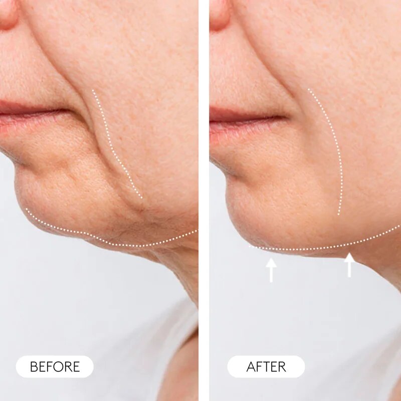 Cocunat Clinical Molecular Therapy feszesítő krém öregedés ellen 50 ml