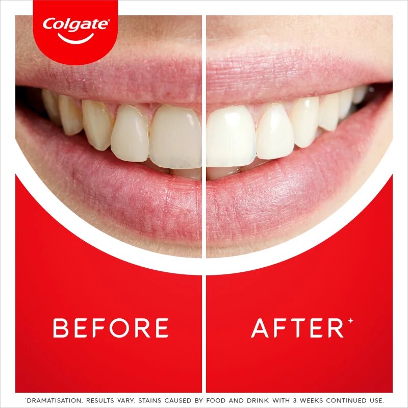 Colgate Max White Ultra Freshness Pearls fehérítő fogkrém 50 ml